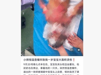 山東菏澤1歲男寶被小熊養生壺炸裂燙傷，商家：原因未明，同款產品仍正常銷售